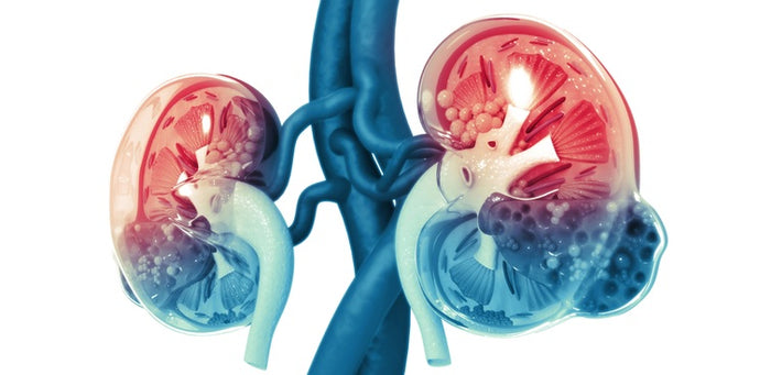 Acute kidney injury