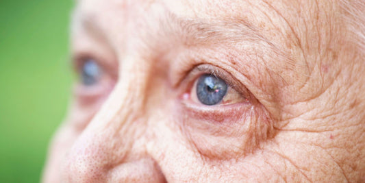 Age-related macular degeneration (AMD)