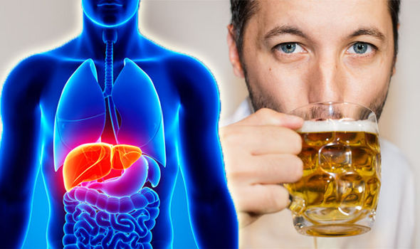 Alcohol-related liver disease