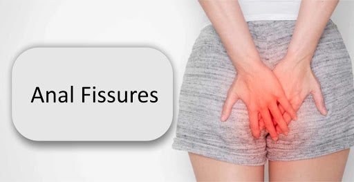 Anal fissure