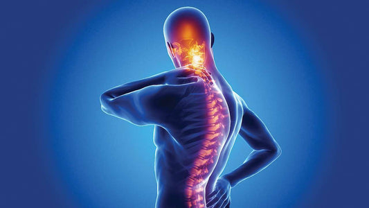 Ankylosing spondylitis