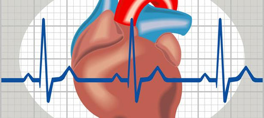 Arrhythmia