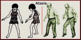 Ataxia