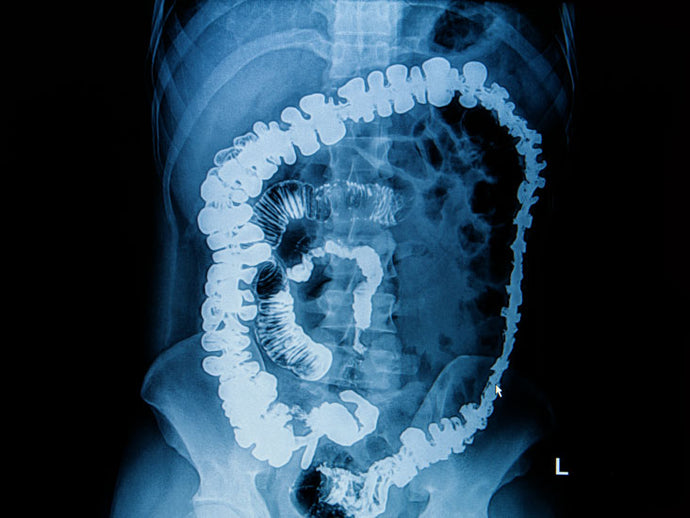 Barium enema