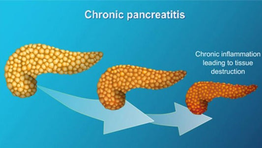 Chronic pancreatitis