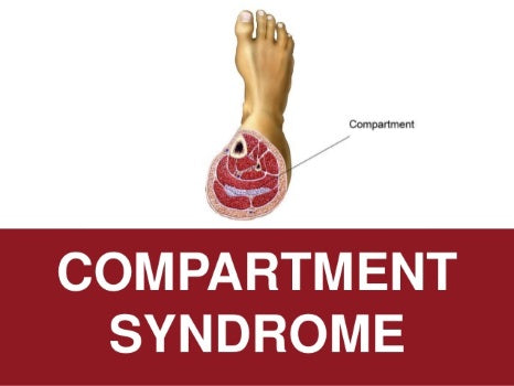 Compartment syndrome