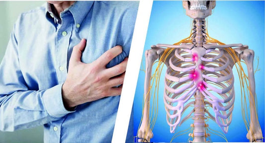 Costochondritis