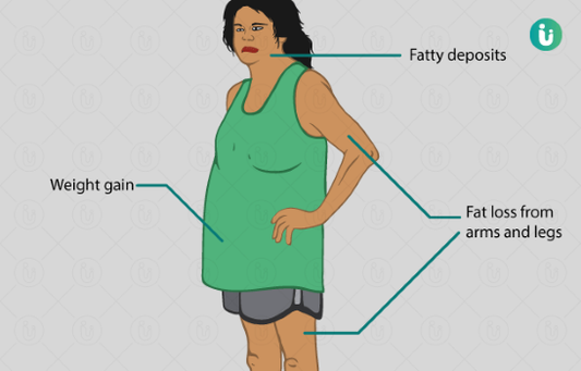 Cushing’s syndrome