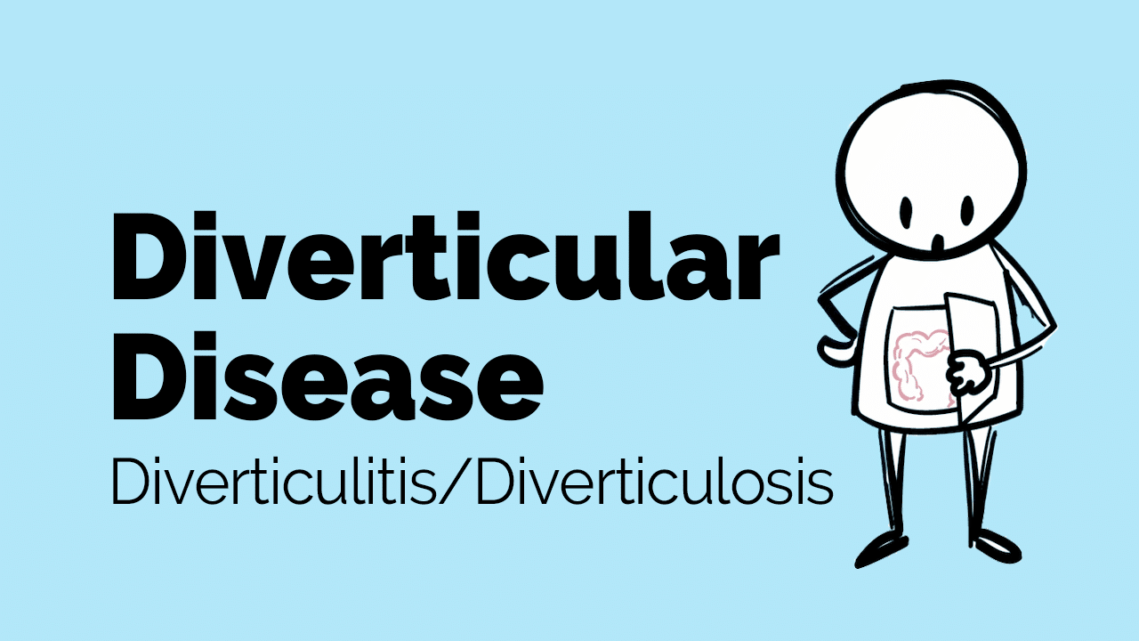 Diverticular disease and diverticulitis – ZimSeller Pharmacy
