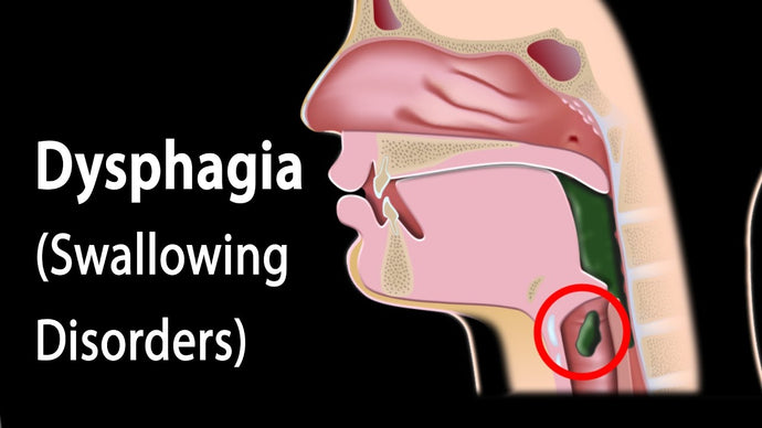 Dysphagia (swallowing problems)