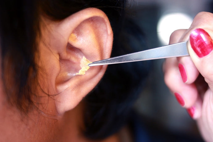 Earwax build-up