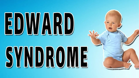 Edwards' syndrome (trisomy 18)