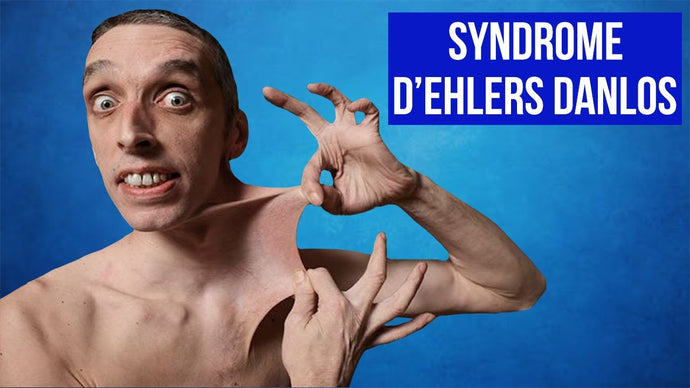 Ehlers-Danlos syndromes