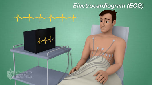 Electrocardiogram (ECG)