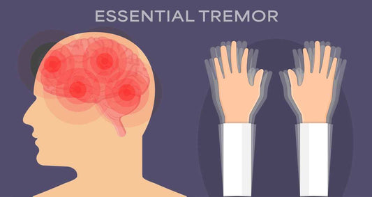 Essential tremor