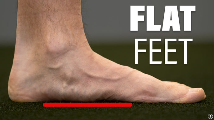 Flat feet