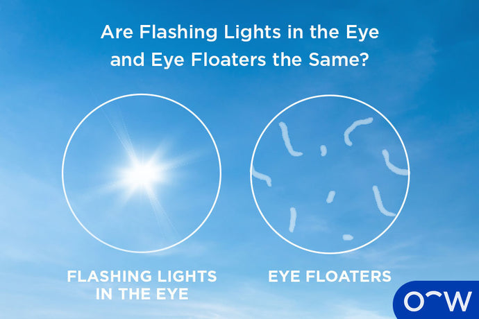 Floaters and flashes in the eyes