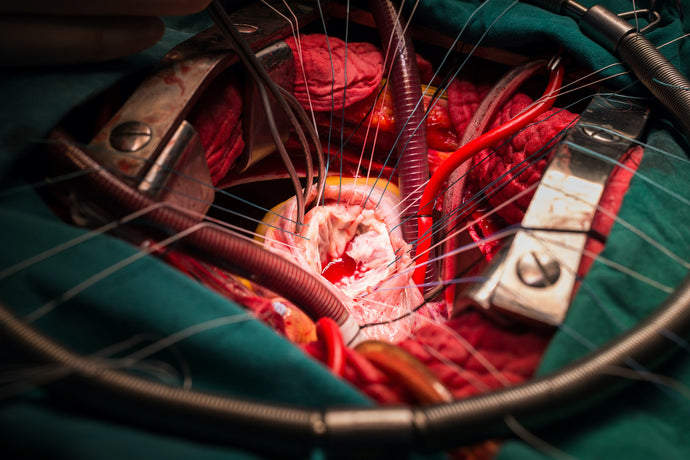 Heart-lung transplant