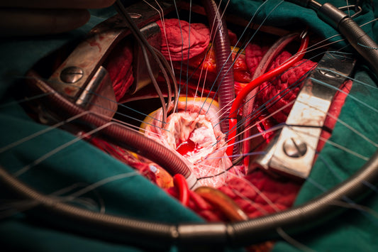 Heart-lung transplant