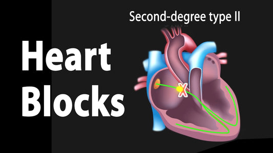 Heart block