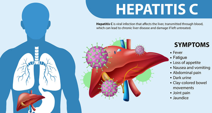 Hepatitis C