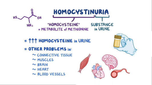 Homocystinuria