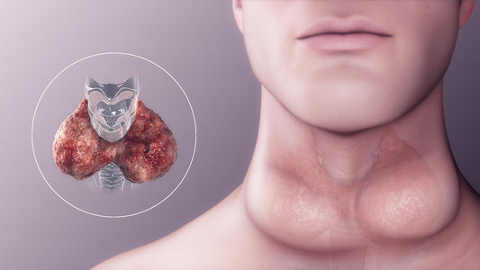 Hypothyroidism