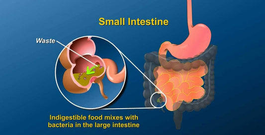 Ileostomy