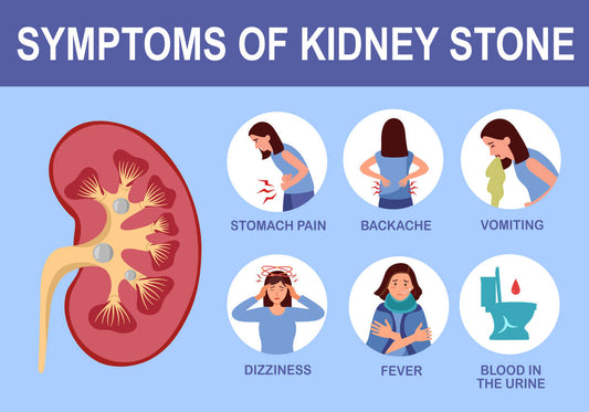 Kidney stones