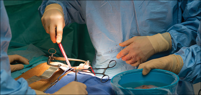 Kidney transplant