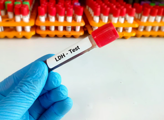 Lactate dehydrogenase (LDH) test