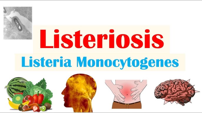 Listeriosis