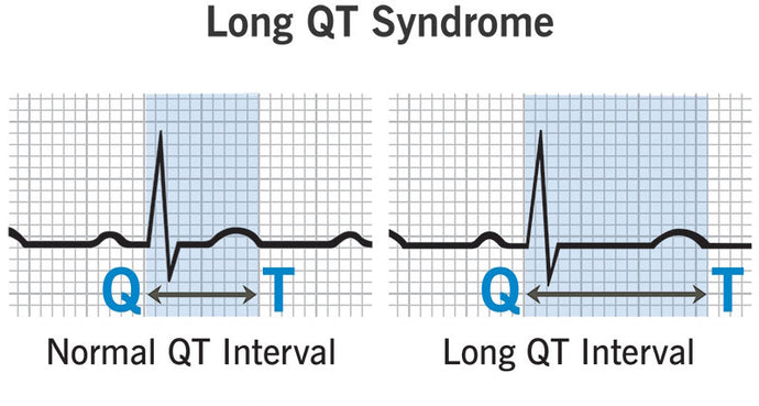 Long QT syndrome