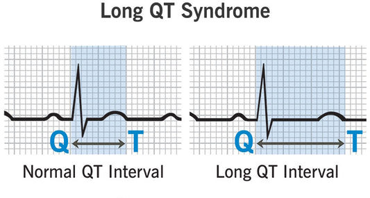 Long QT syndrome