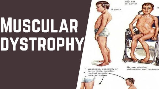 Muscular dystrophy