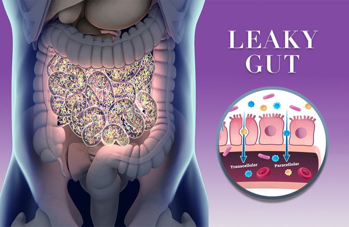 Leaky gut syndrome