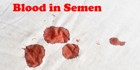 Blood in semen (haematospermia)