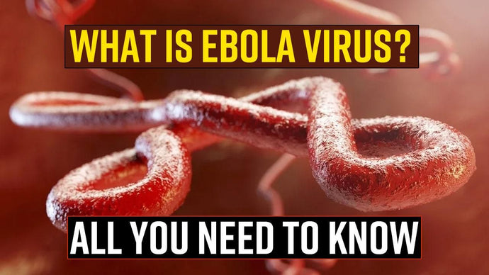 Ebola virus disease