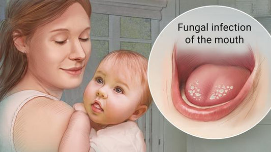 Antifungal medicines