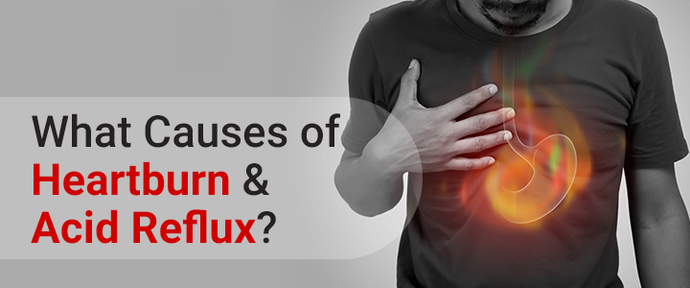 Heartburn and acid reflux